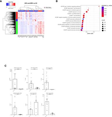 The genomic landscape of ANCA-associated vasculitis: Distinct transcriptional signatures, molecular endotypes and comparison with systemic lupus erythematosus